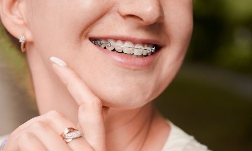 consejos para cuidar de la ortodoncia